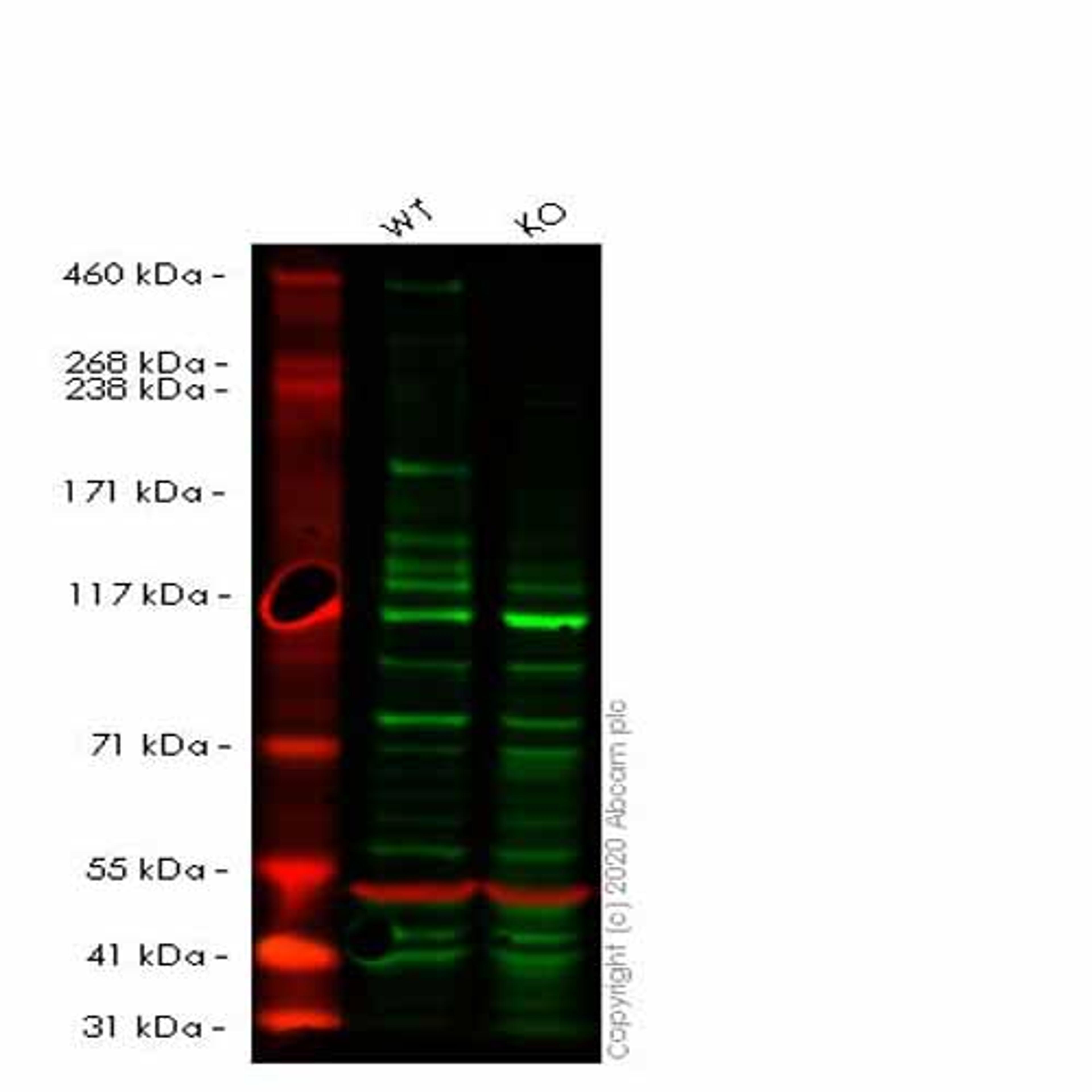 Human TOP2B (Topoisomerase II beta) knockout HEK293T cell line - Abcam plc - Life Sciences