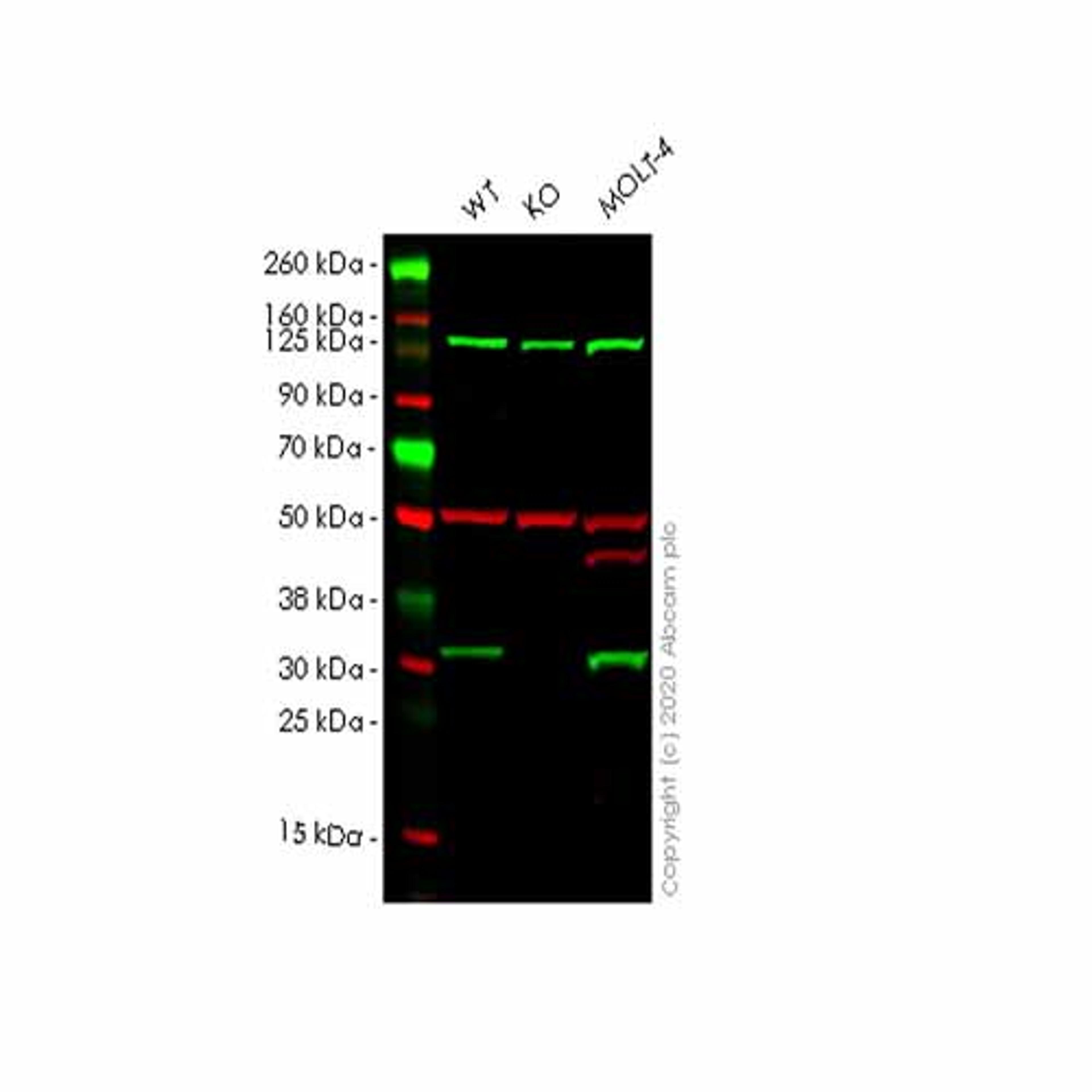 Human CNOT7 knockout HeLa cell line - Abcam plc - Life Sciences