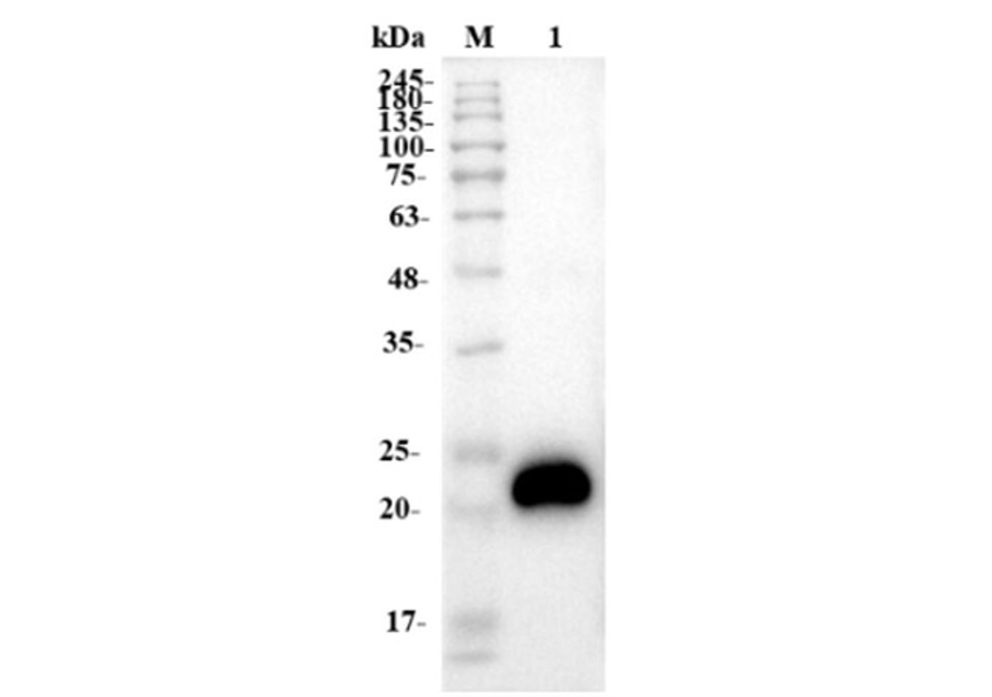 Anti-Human VEGF Recombinant Antibody (Bevacizumab)