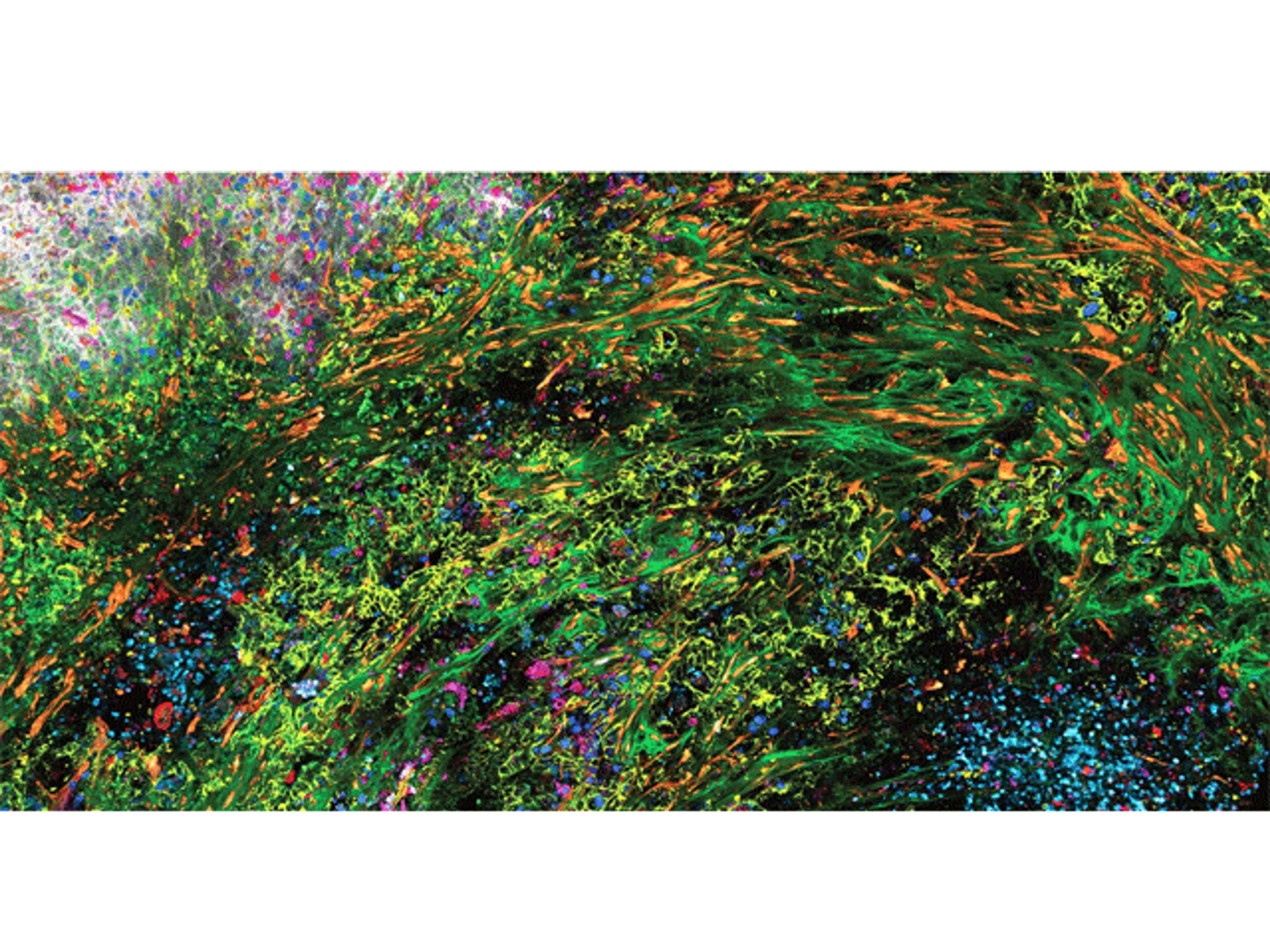 SpectraPlex 3D High-Multiplex Solution for Spatial Discoveries - Leica Microsystems Europe - Life Sciences