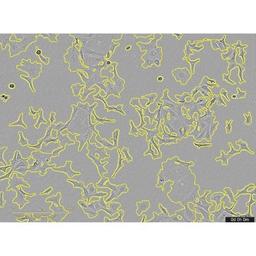 Incucyte® AI Confluence Analysis - Sartorius Group - Life Sciences