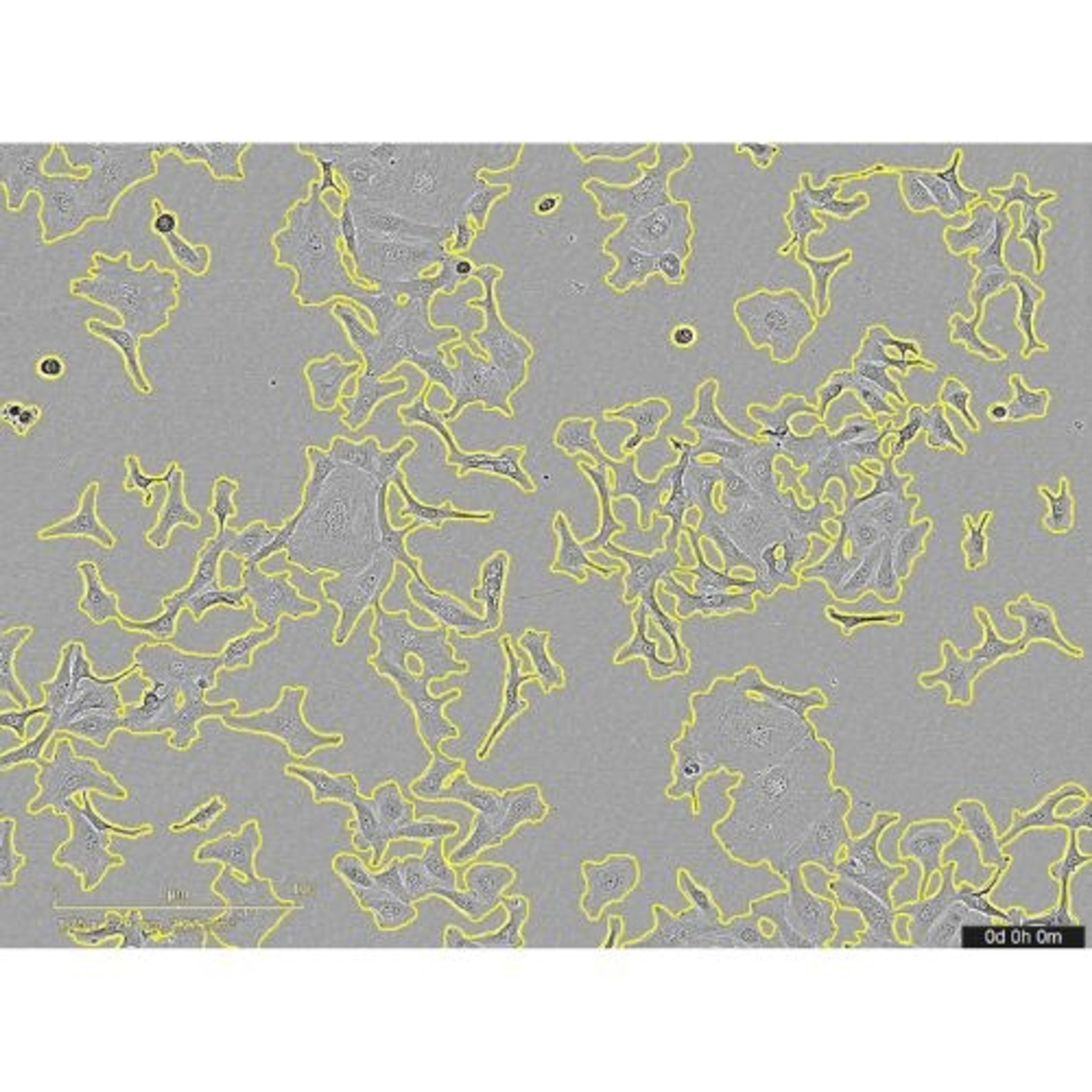 Incucyte® AI Confluence Analysis - Sartorius Group - Life Sciences