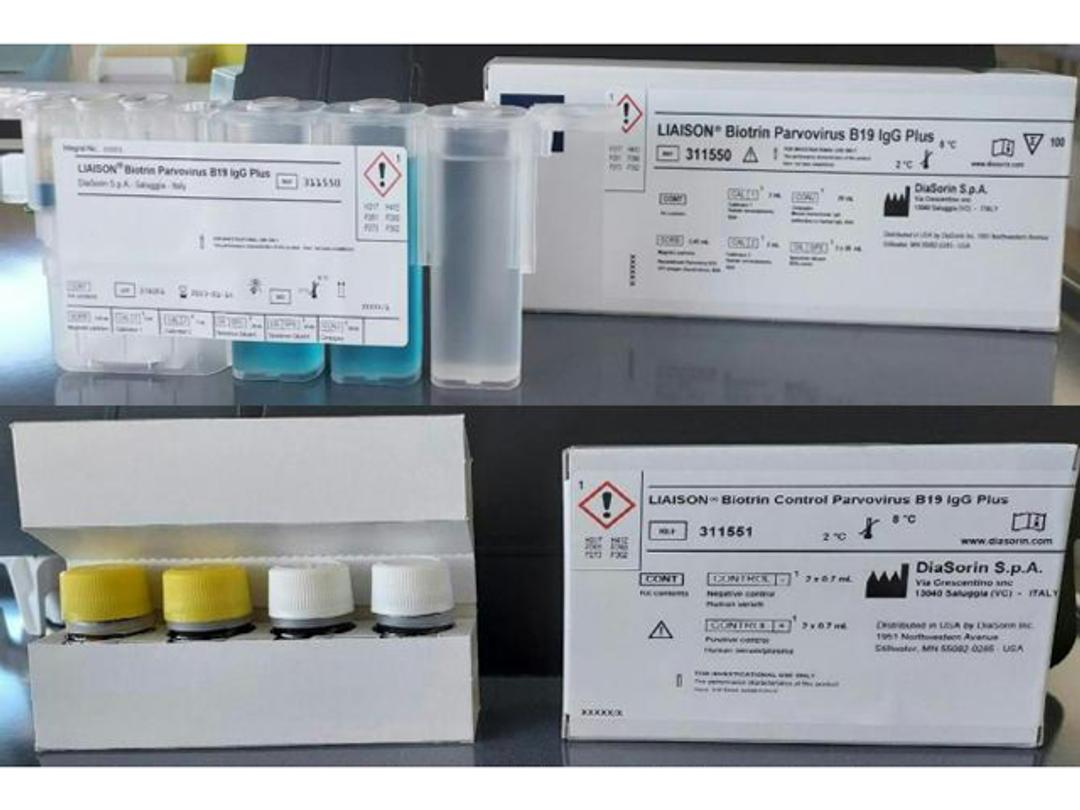 LIAISON® Biotrin Parvovirus B19 IgG Plus - Diasorin Ltd - Clinical Diagnostics