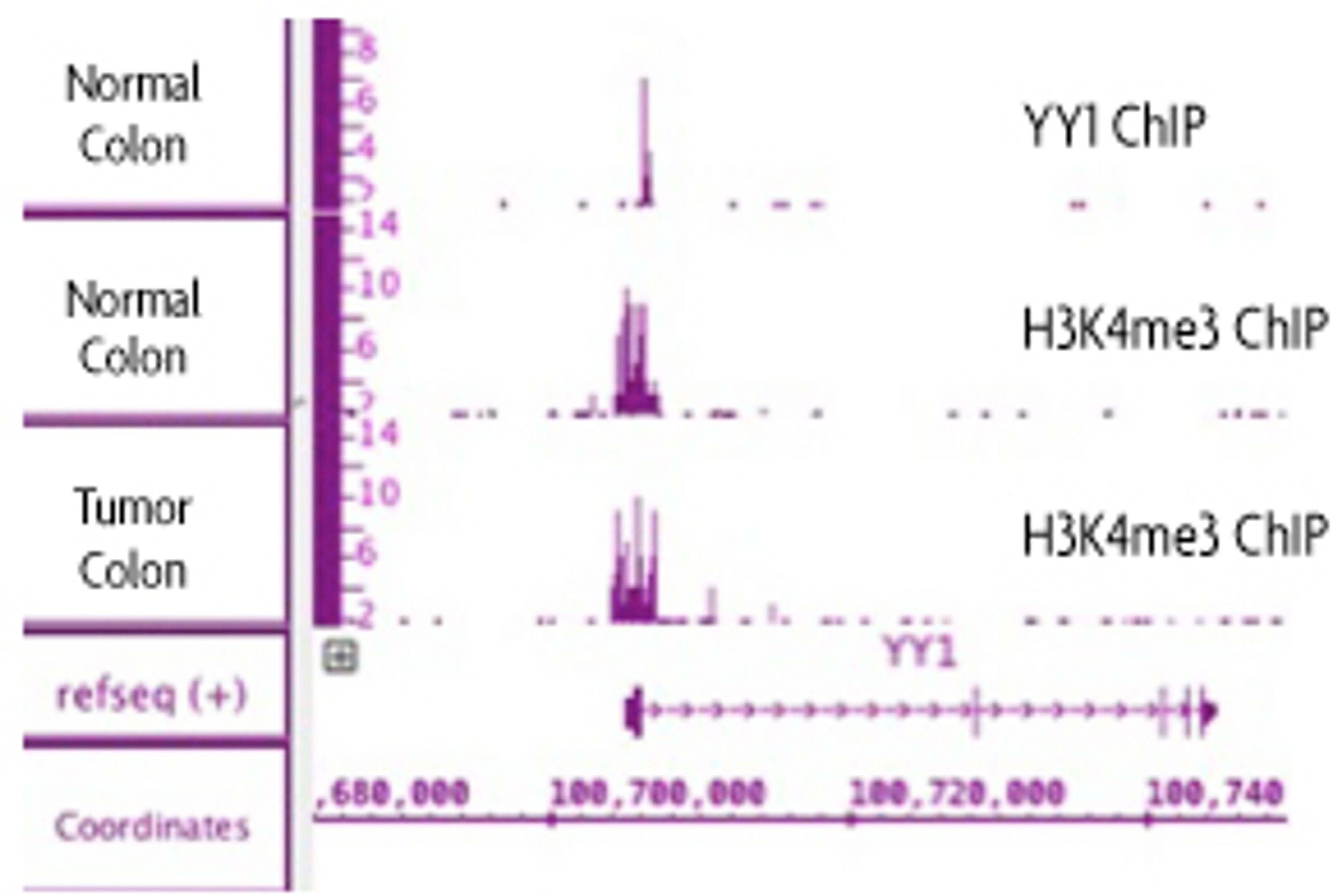 ChIP-IT® FFPE Kit - Active Motif - Life Sciences