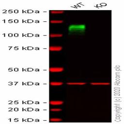 Human ITGB1 (CD29) knockout HCT116 cell line - Abcam plc - Life Sciences