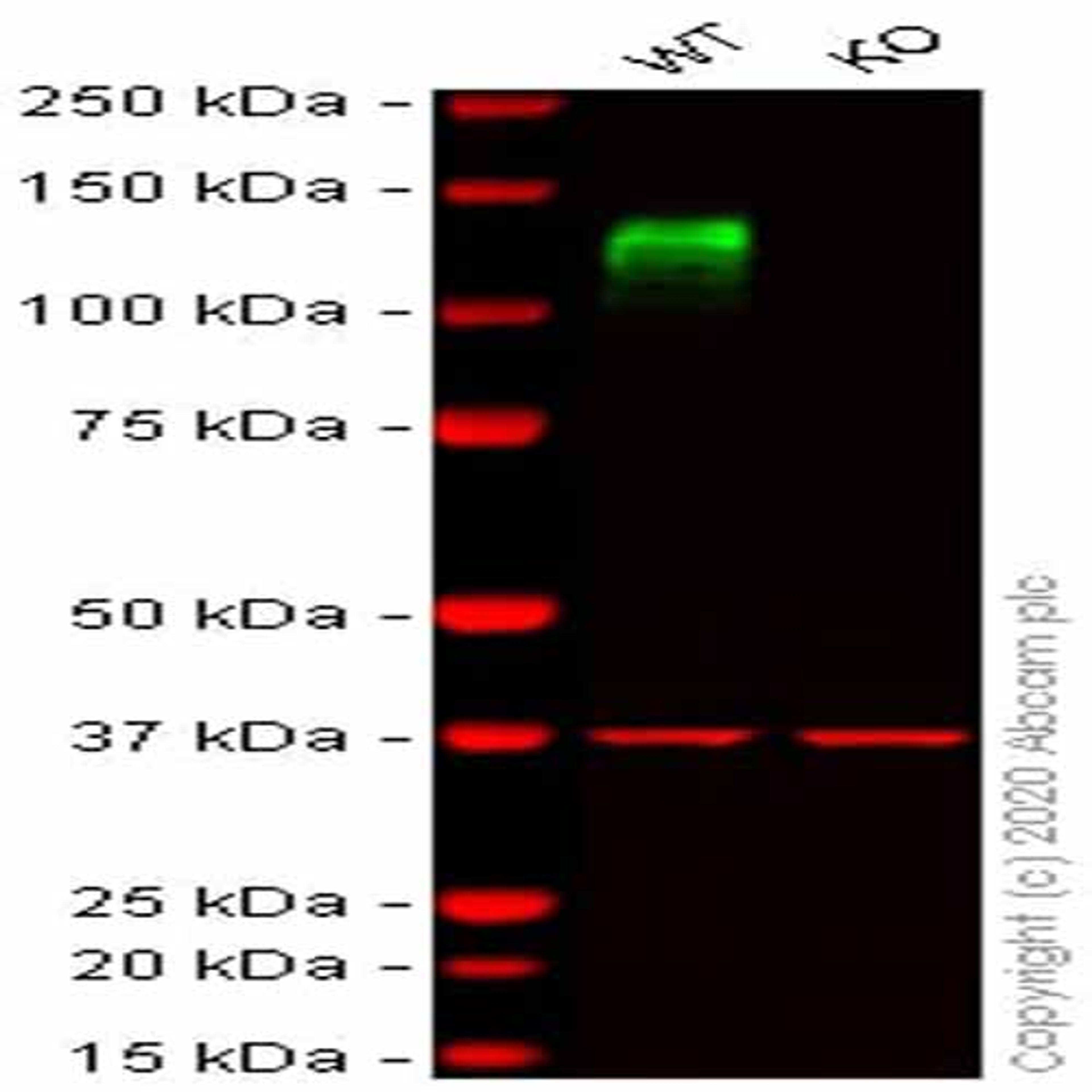 Human ITGB1 (CD29) knockout HCT116 cell line - Abcam plc - Life Sciences