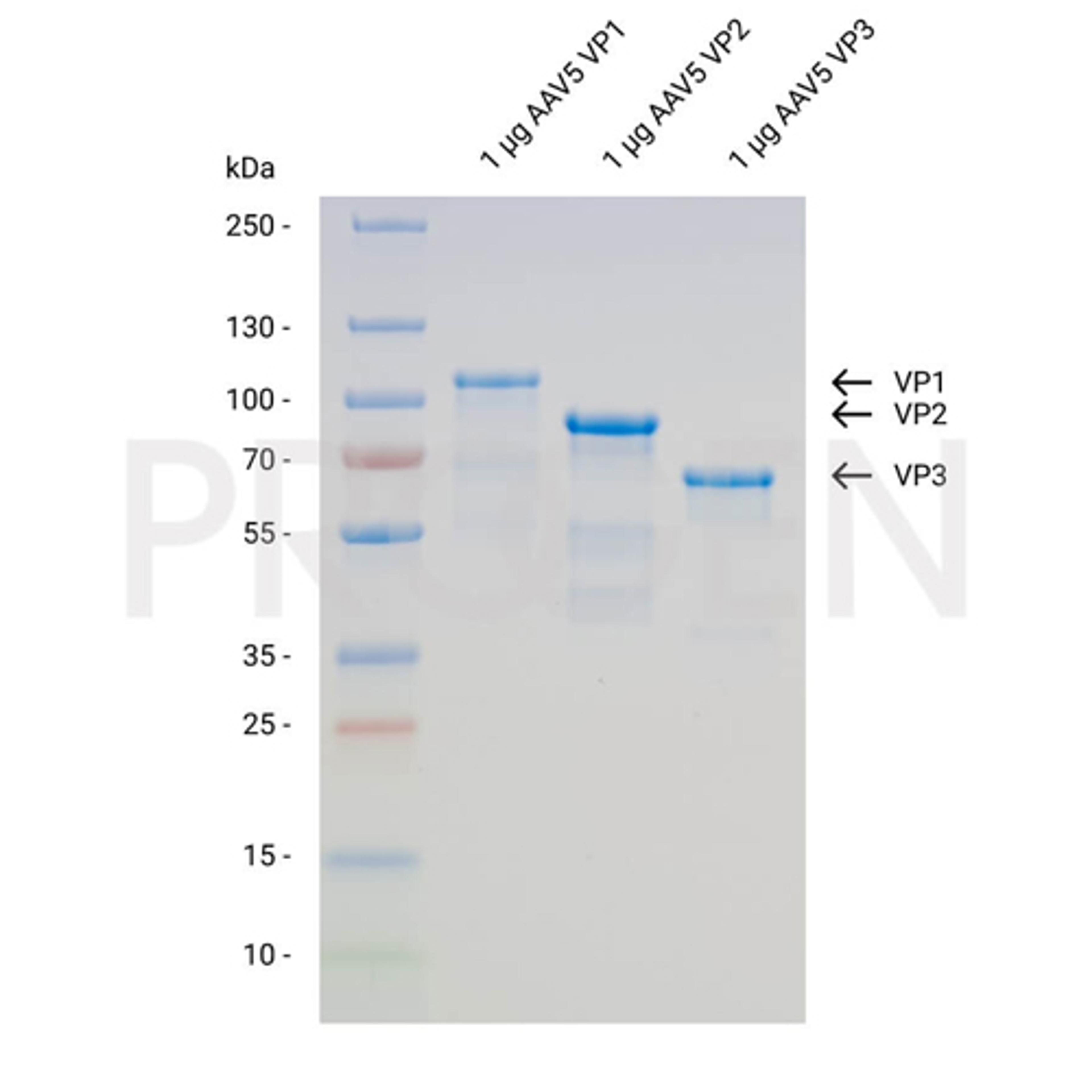 AAV5 VP1 + VP2 + VP3, recombinant proteins, set - PROGEN