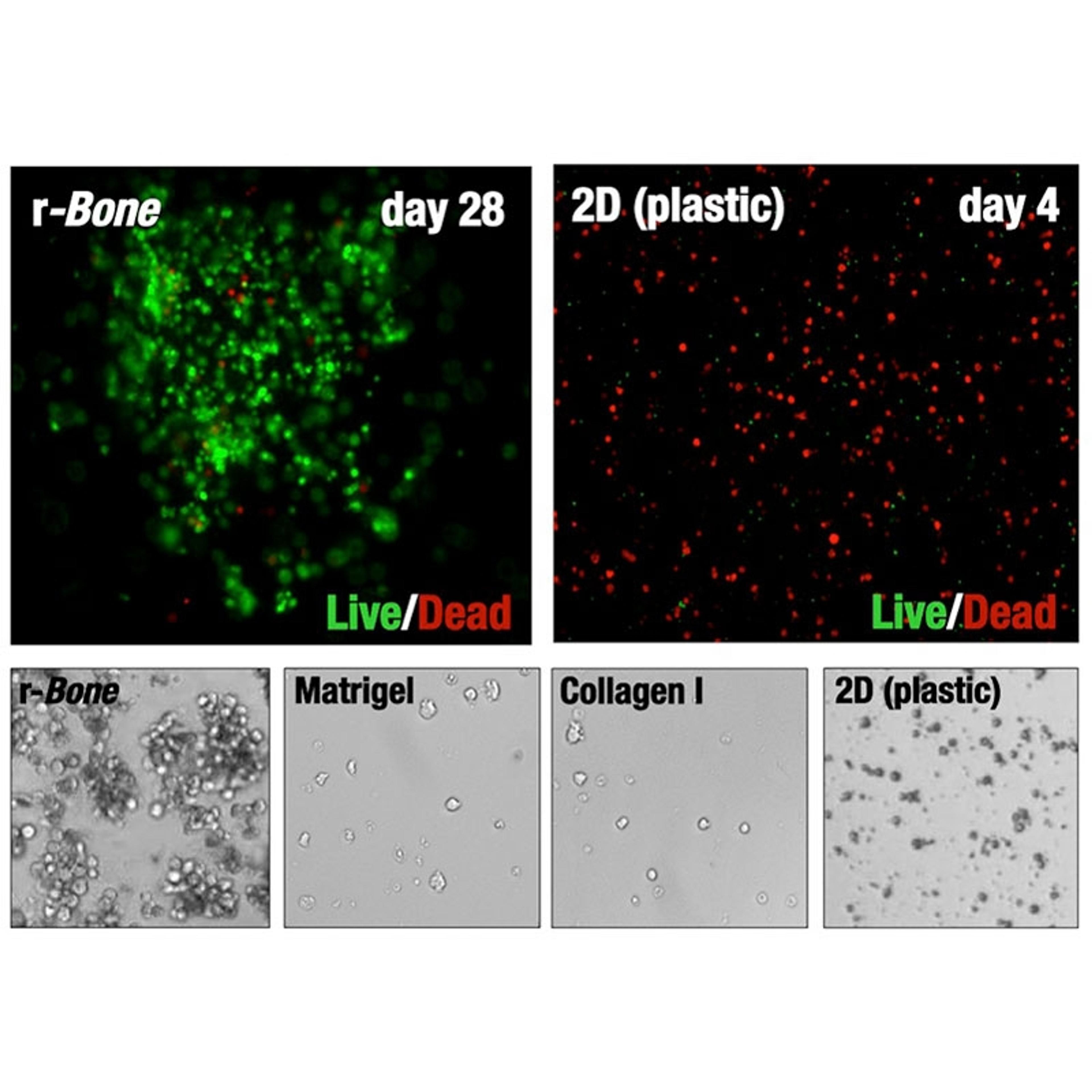 Reconstructed Bone (r-Bone™) 3D Cell Culture Service, Acute Myelogenous Leukemia (AML) - zPREDICTA - Life Sciences
