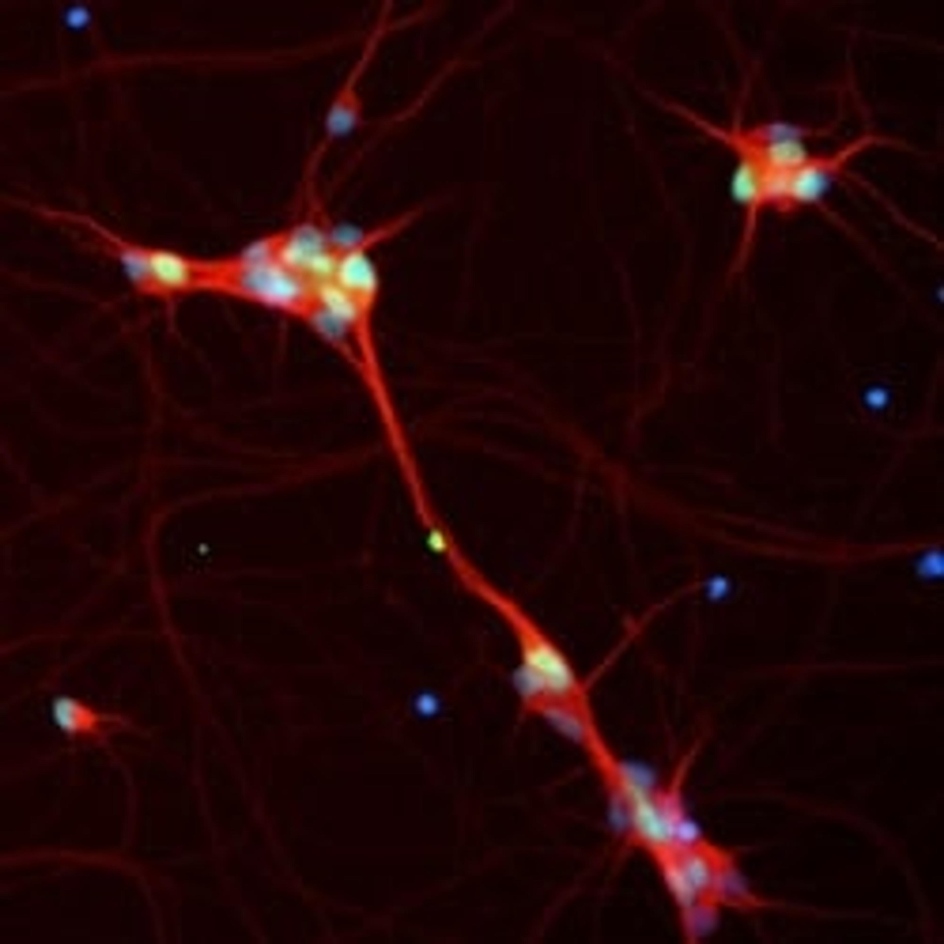 Custom Batch Neurons - BrainXell - Life Sciences