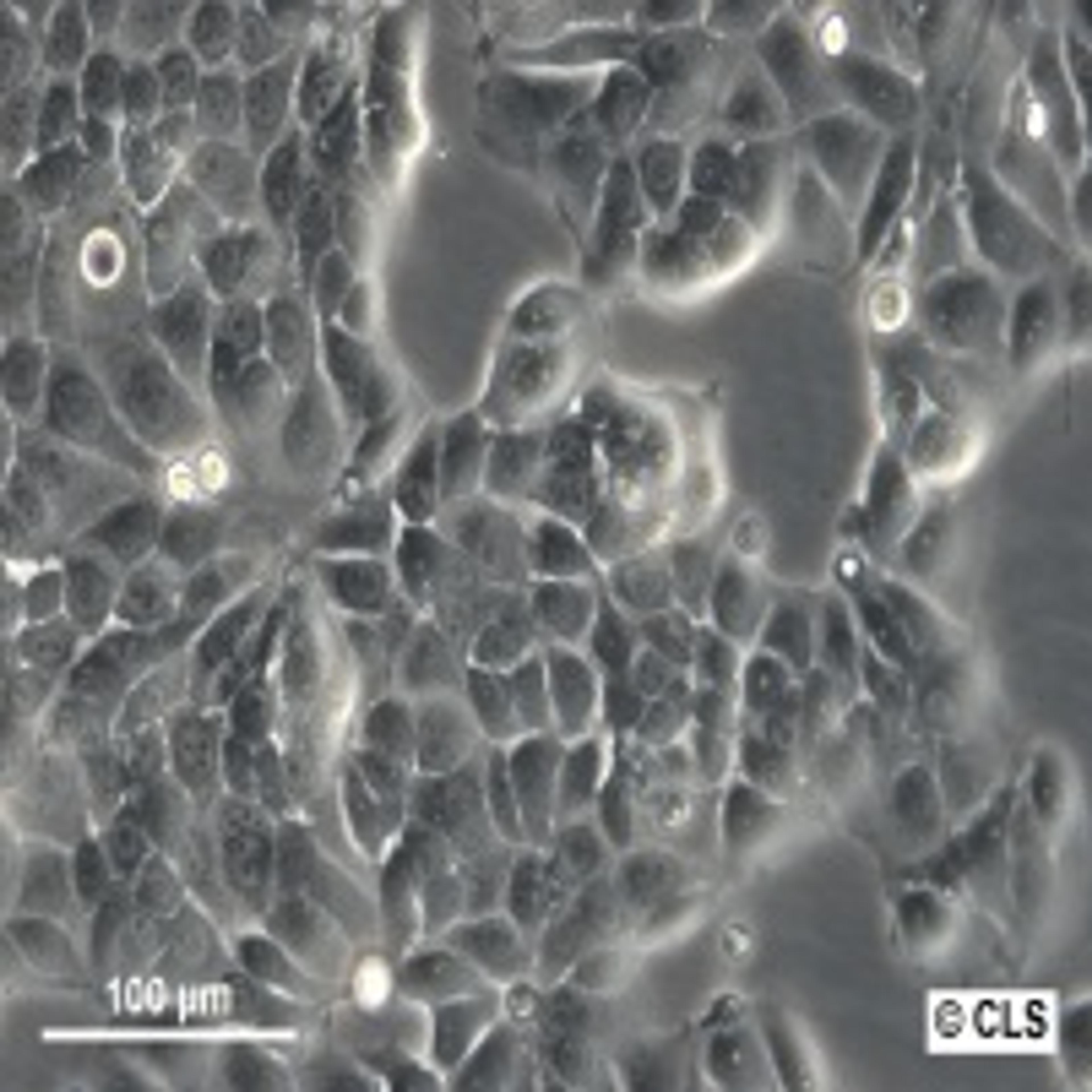 MCF-7 - Cell Lines Service GmbH - Life Sciences