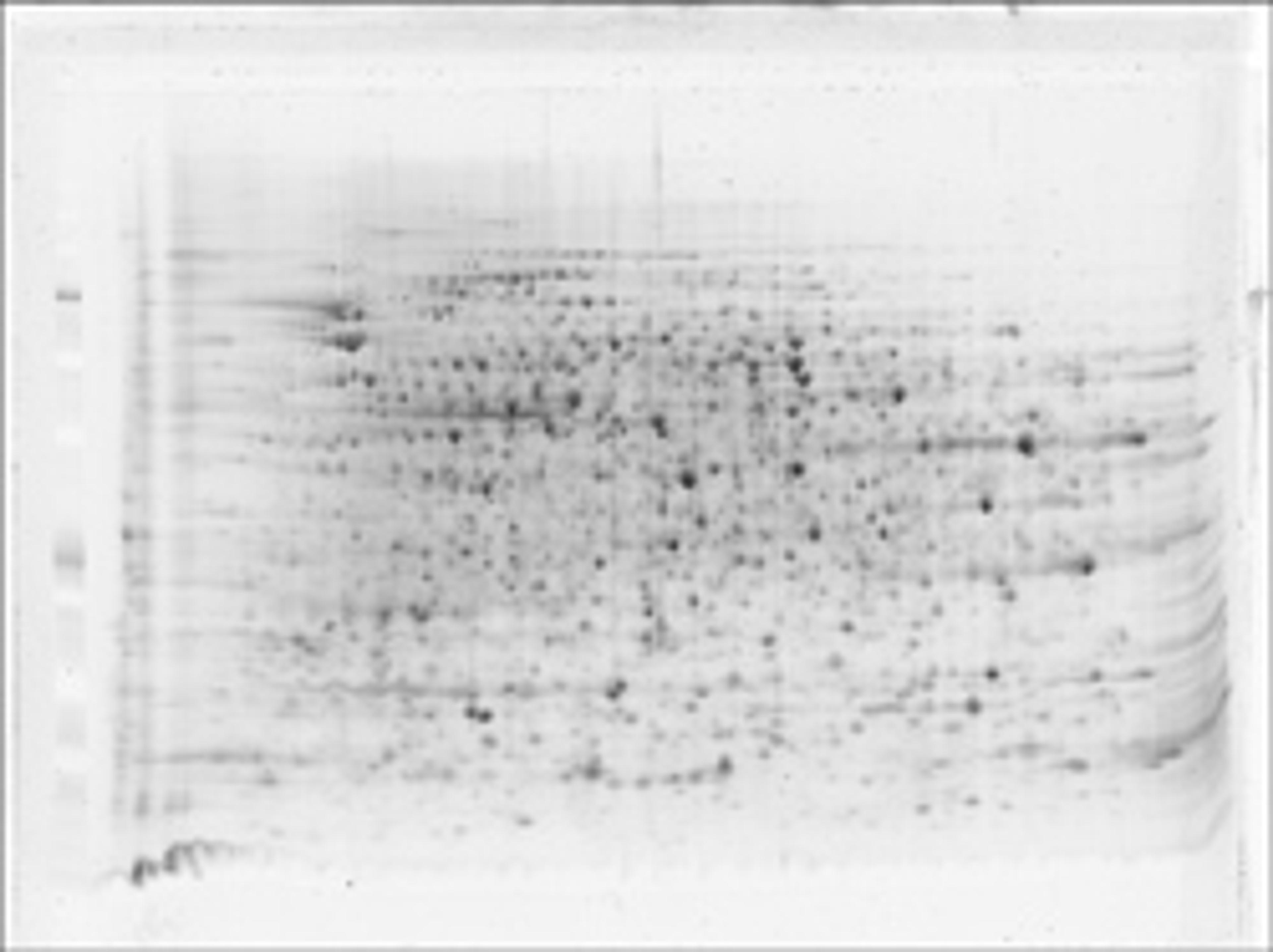 2D HPE™ Large Gel NF 12.5% Kit - SERVA Electrophoresis GmbH - Life Sciences