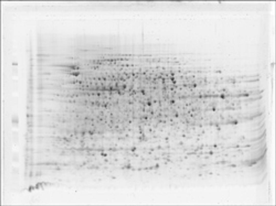2D HPE™ Large Gel NF 12.5% Kit - SERVA Electrophoresis GmbH - Life Sciences