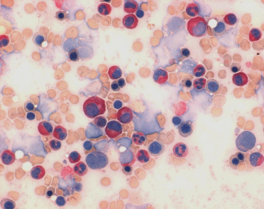 LEUCOGNOST NASDCL NEW - Merck KGaA, Darmstadt, Germany - Clinical Diagnostics