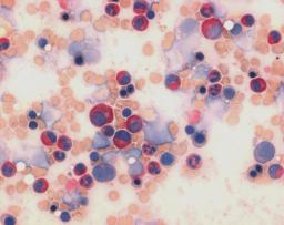 LEUCOGNOST NASDCL NEW - Merck KGaA, Darmstadt, Germany - Clinical Diagnostics