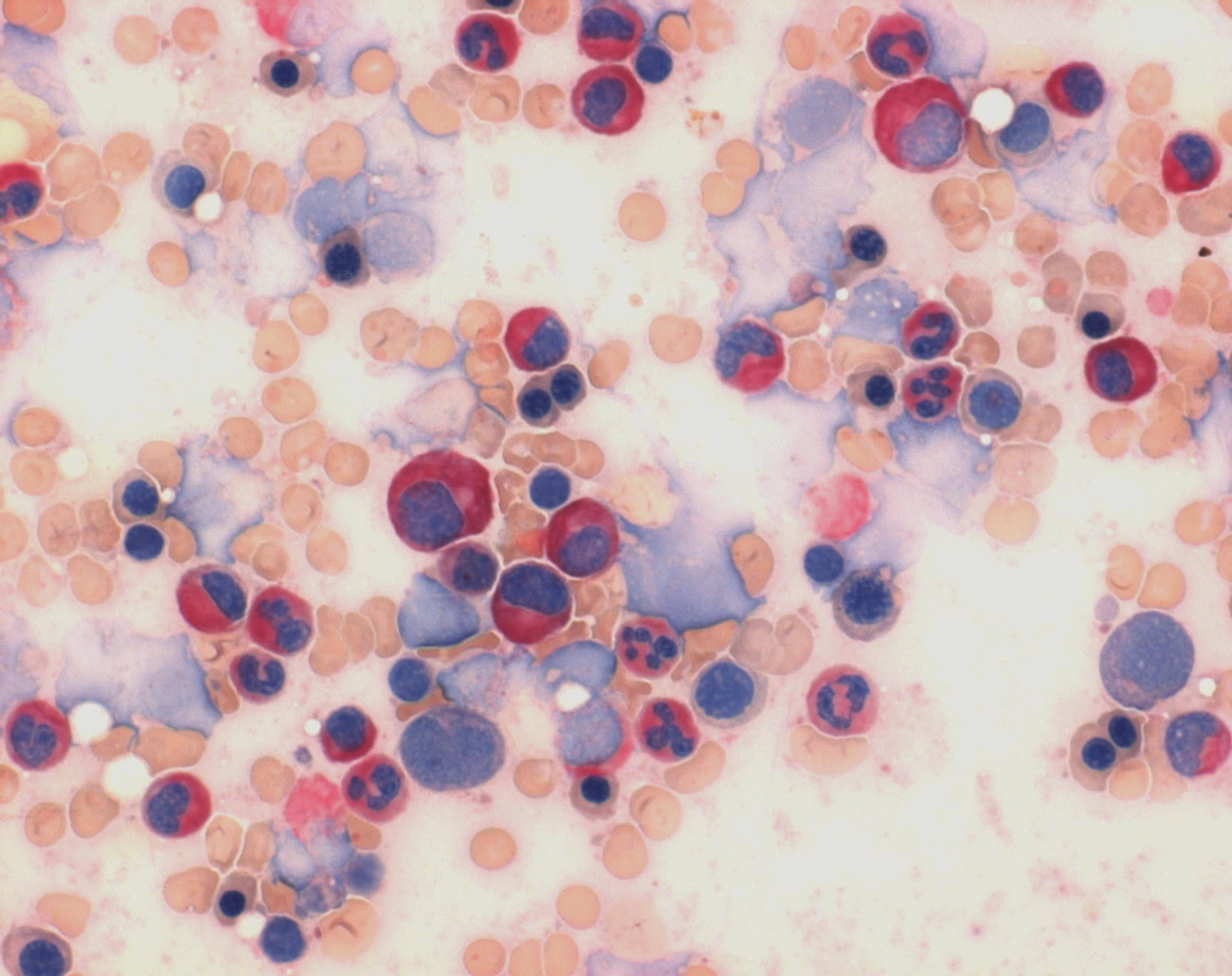 LEUCOGNOST NASDCL NEW - Merck KGaA, Darmstadt, Germany - Clinical Diagnostics