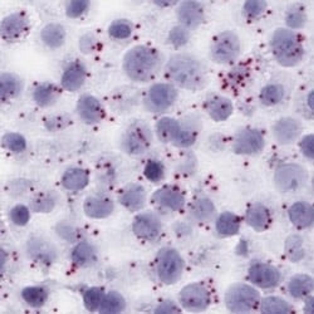 BaseScope™ Assays - Advanced Cell Diagnostics - Life Sciences