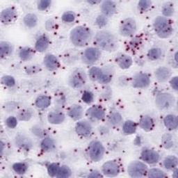 BaseScope™ Assays - Advanced Cell Diagnostics - Life Sciences