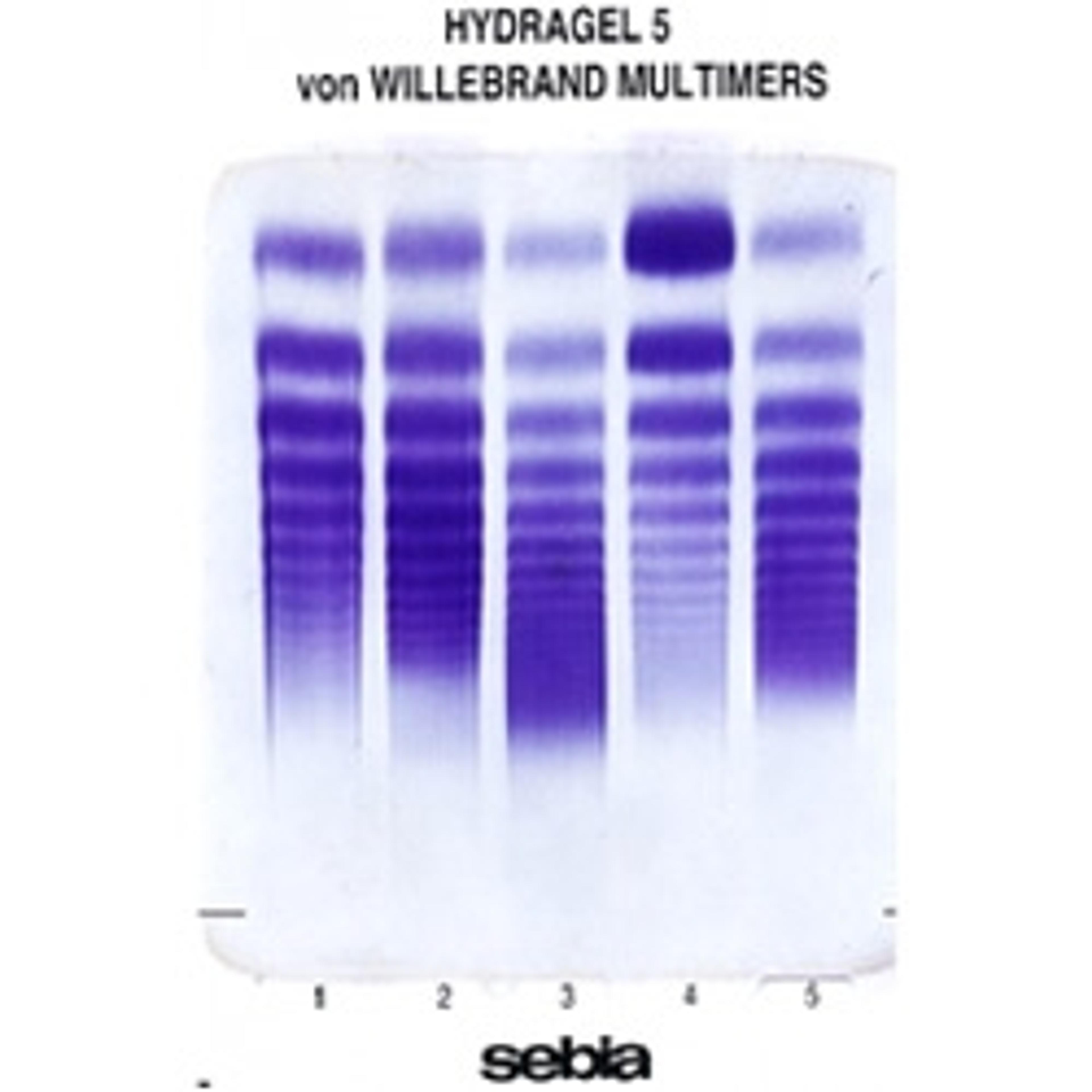 HYDRAGEL 5 VON WILLEBRAND MULTIMERS - Sebia (UK) Limited