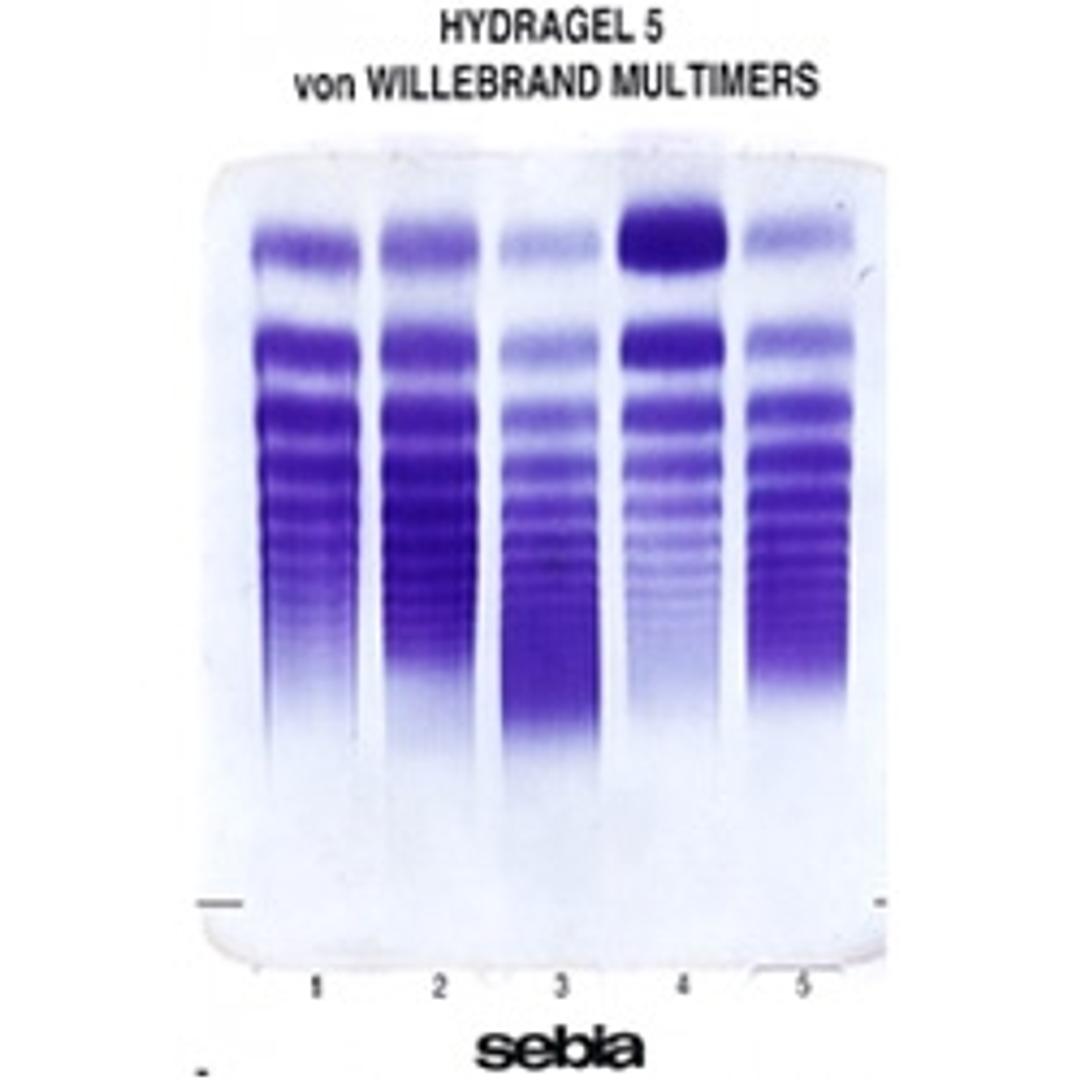 HYDRAGEL 5 VON WILLEBRAND MULTIMERS - Sebia (UK) Limited