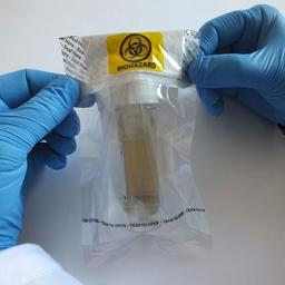 ShuttlePouch™- Leak Proof Sample Transport Solution - Alpha Laboratories Ltd - Lab Automation
