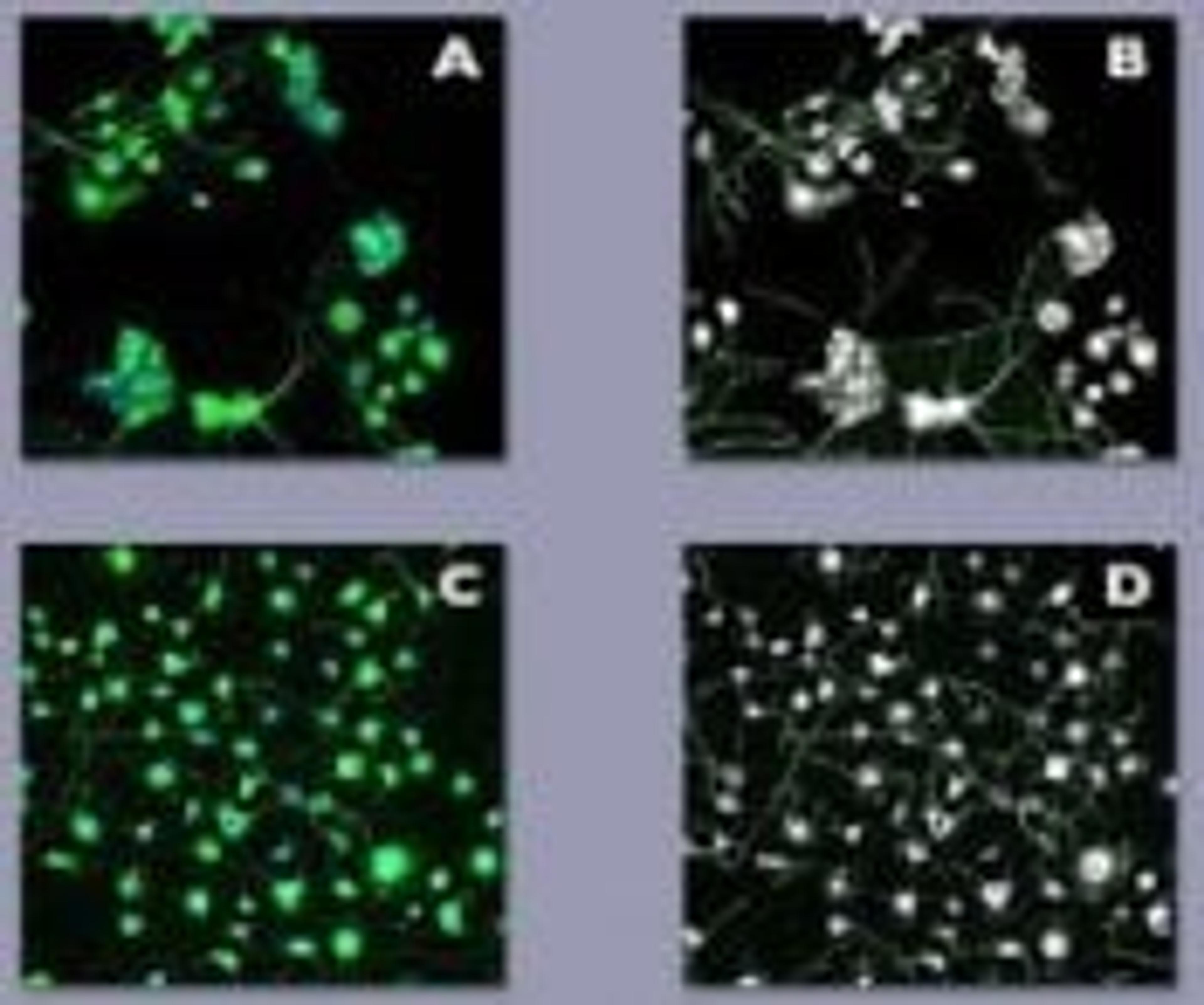 Neuroscreen™;-1 Cells, Commercial Package - null - Life Sciences