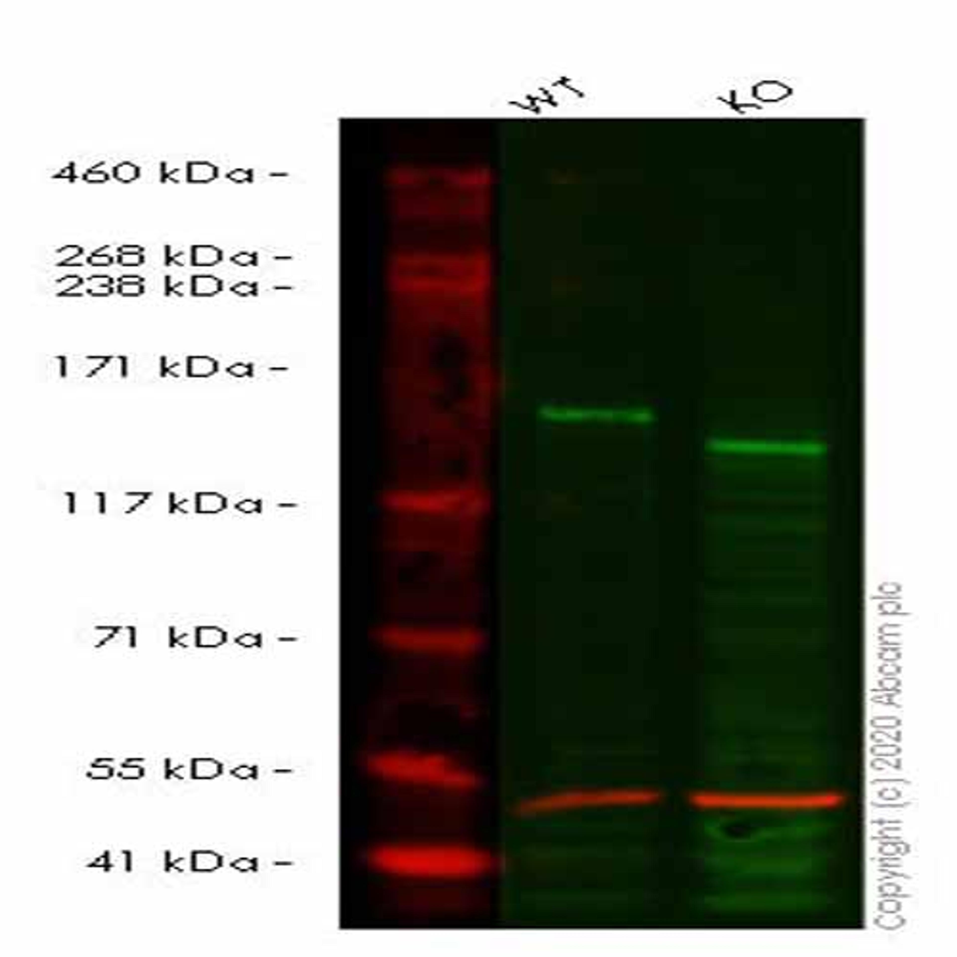 Human ROCK1 knockout HeLa cell line - Abcam plc - Life Sciences