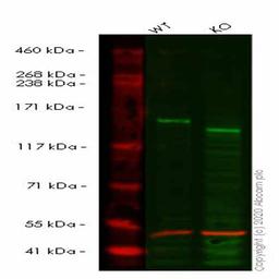 Human ROCK1 knockout HeLa cell line - Abcam plc - Life Sciences