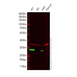 Human CA2 (Carbonic anhydrase 2) knockout HEK293T cell line - Abcam plc - Life Sciences