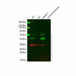 Human HPSE (Heparanase 1) knockout HeLa cell line - Abcam plc - Life Sciences
