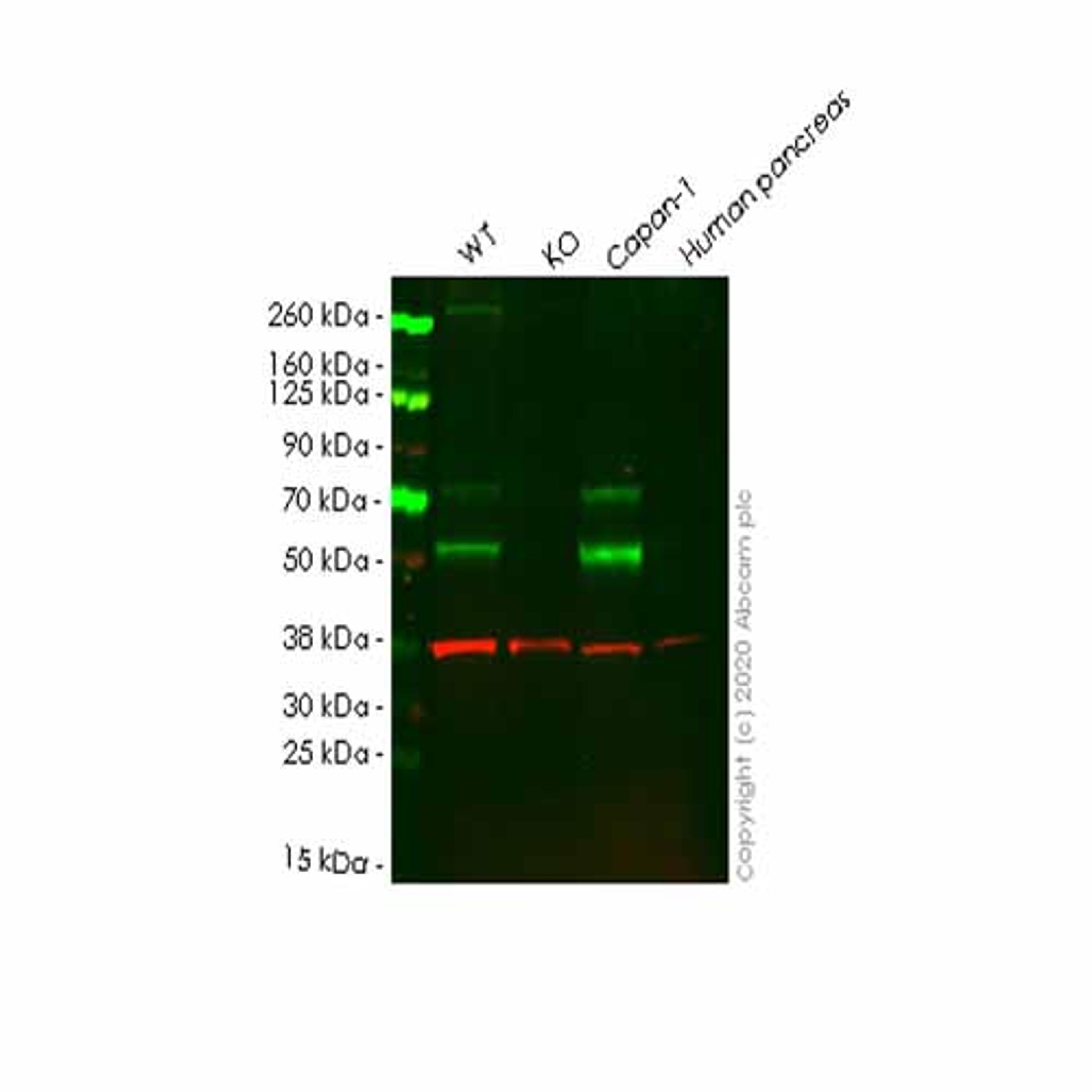 Human HPSE (Heparanase 1) knockout HeLa cell line - Abcam plc - Life Sciences