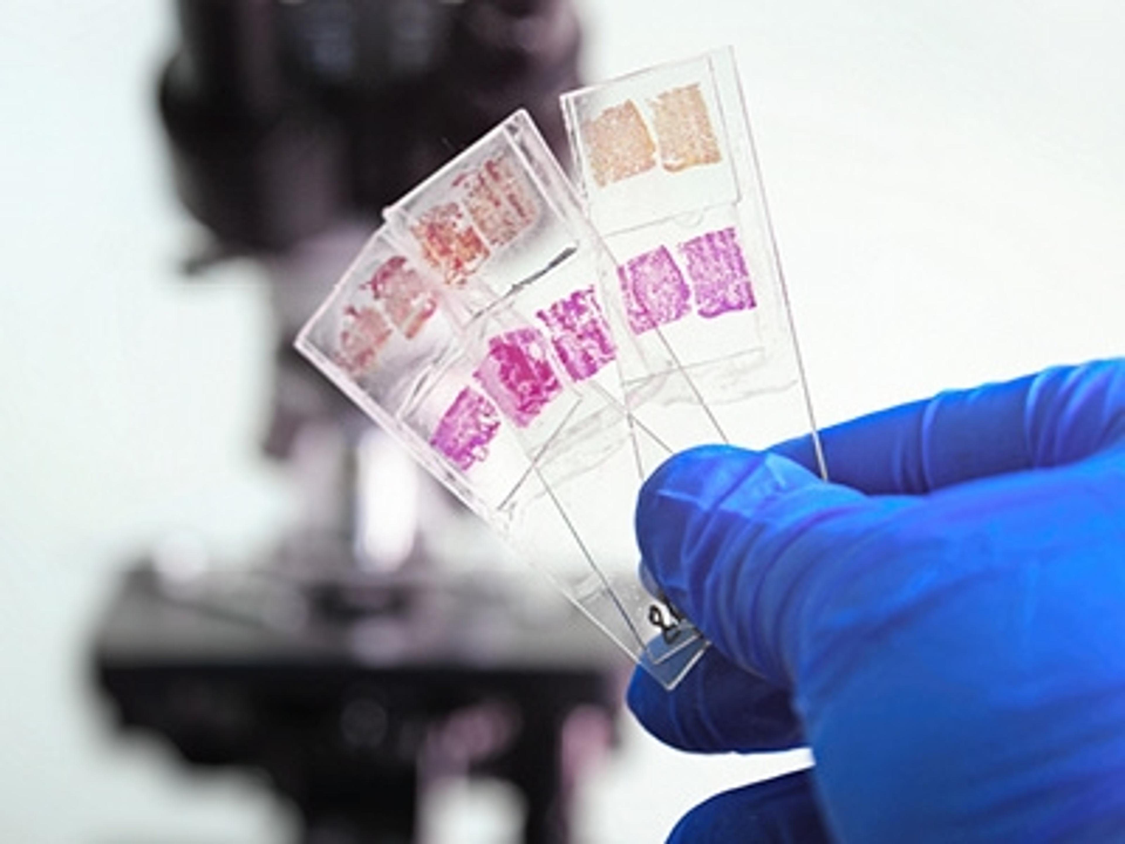 Tissue Samples for Research - The Niche CRO Group - Life Sciences