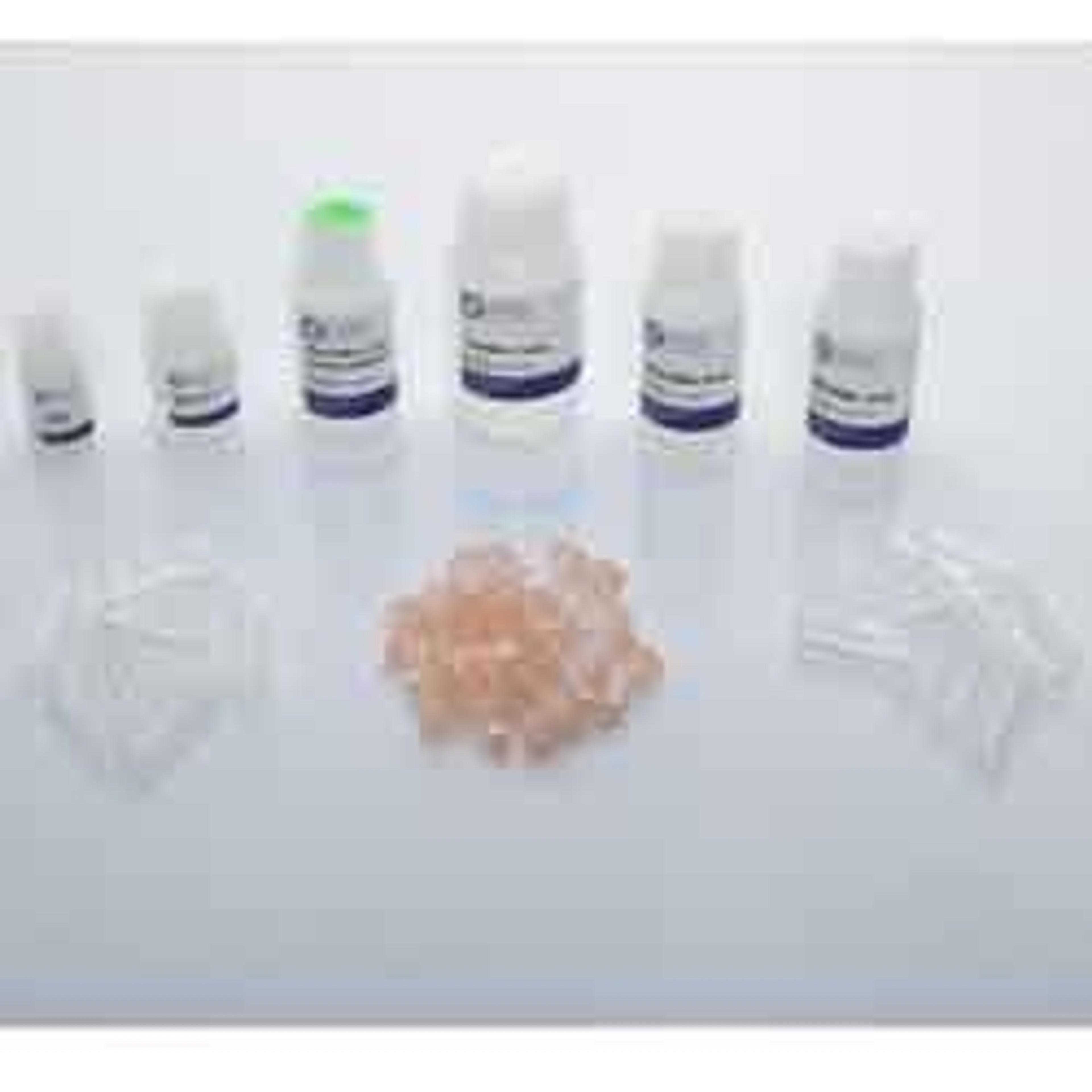 Bead Mill Yeast RNA Kit - OMNI International Inc. - Life Sciences