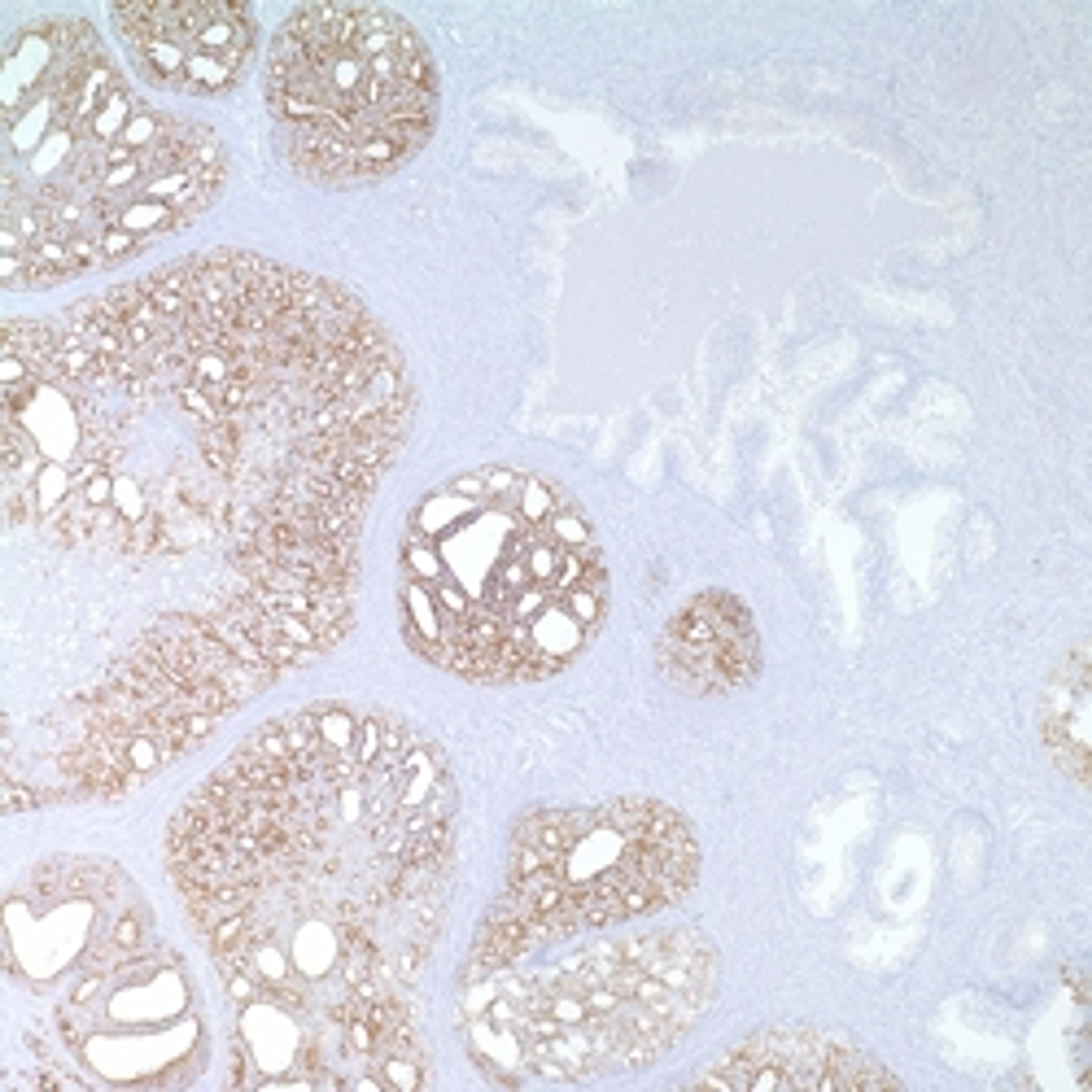 P504s (13H4) - Merck - Life Sciences