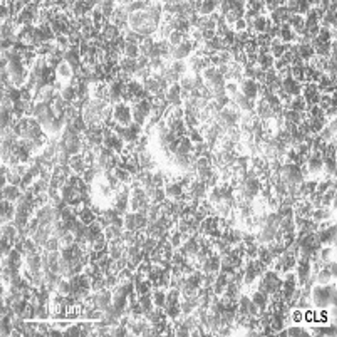 BT-474 - Cell Lines Service GmbH - Life Sciences