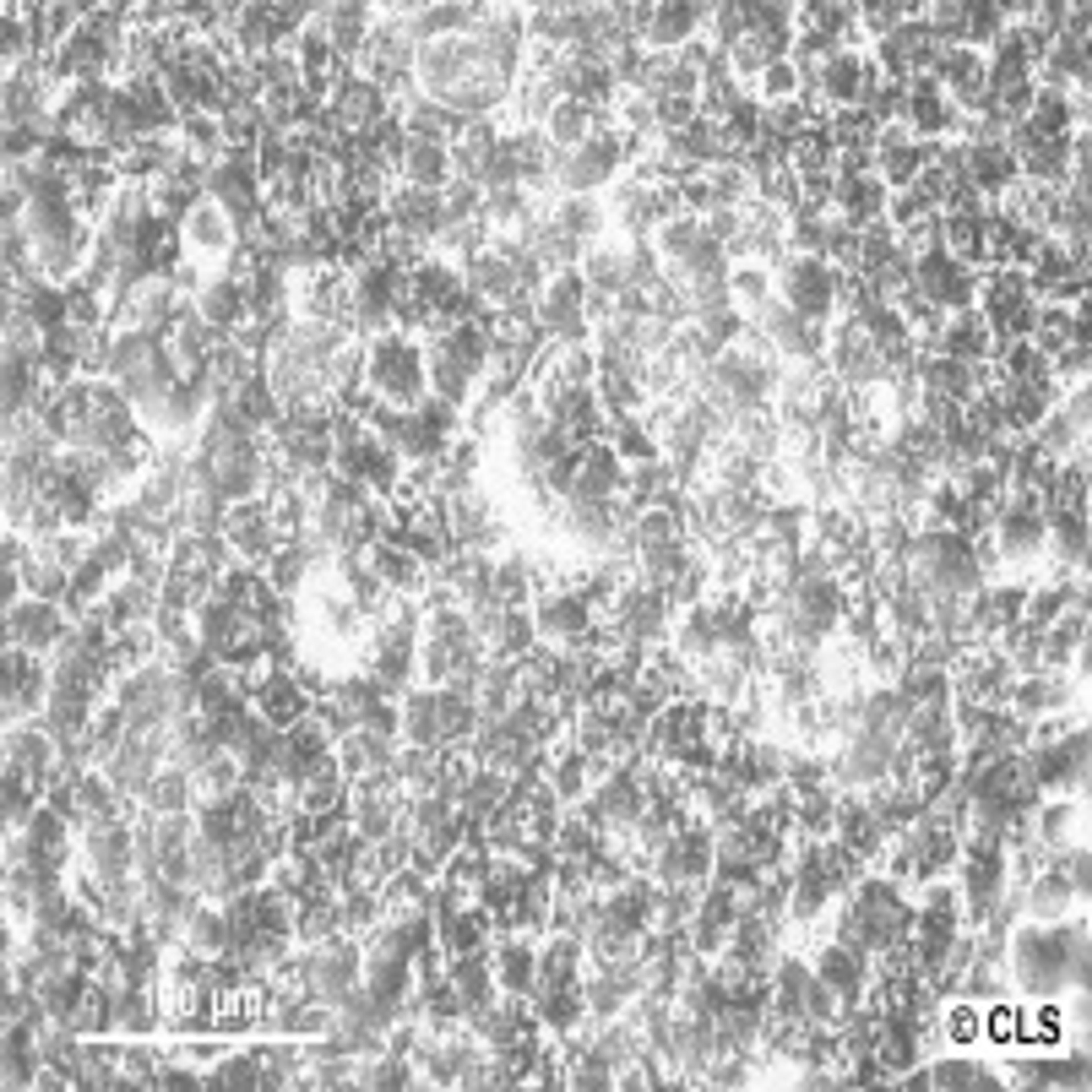 BT-474 - Cell Lines Service GmbH - Life Sciences