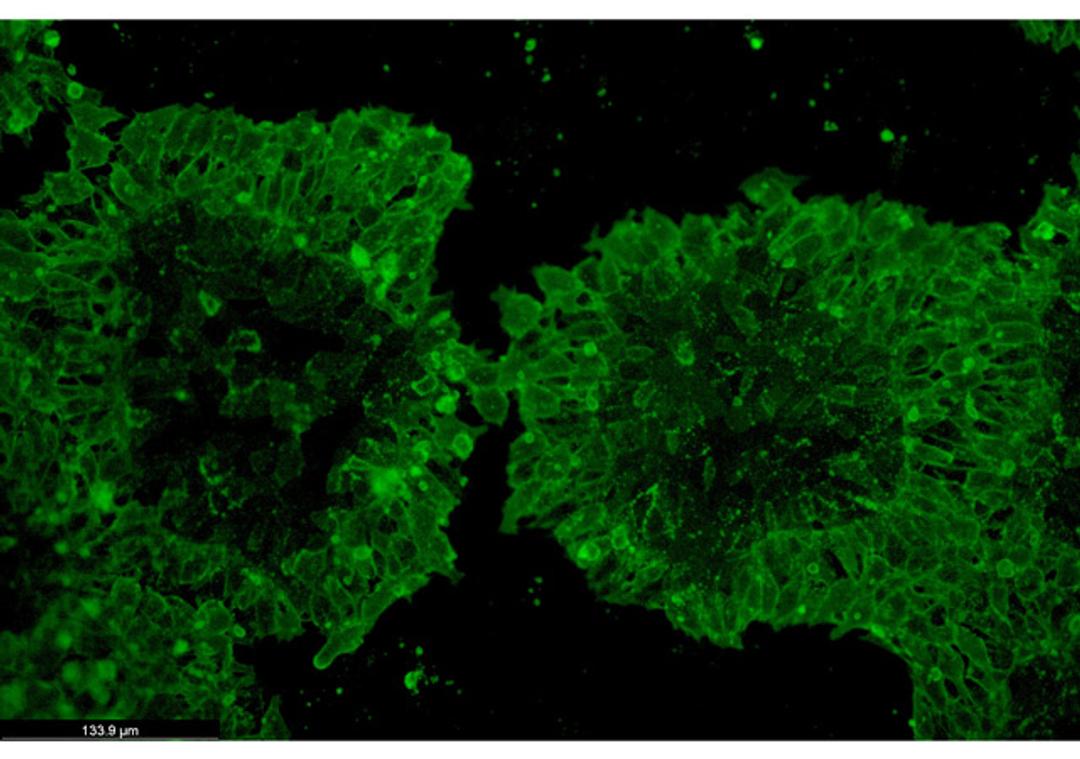 TARGATT™ iPSCs Kits - Applied StemCell - Drug Discovery & Development