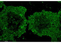 TARGATT™ iPSCs Kits - Applied StemCell - Drug Discovery & Development