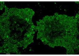 TARGATT™ iPSCs Kits - Applied StemCell - Drug Discovery & Development