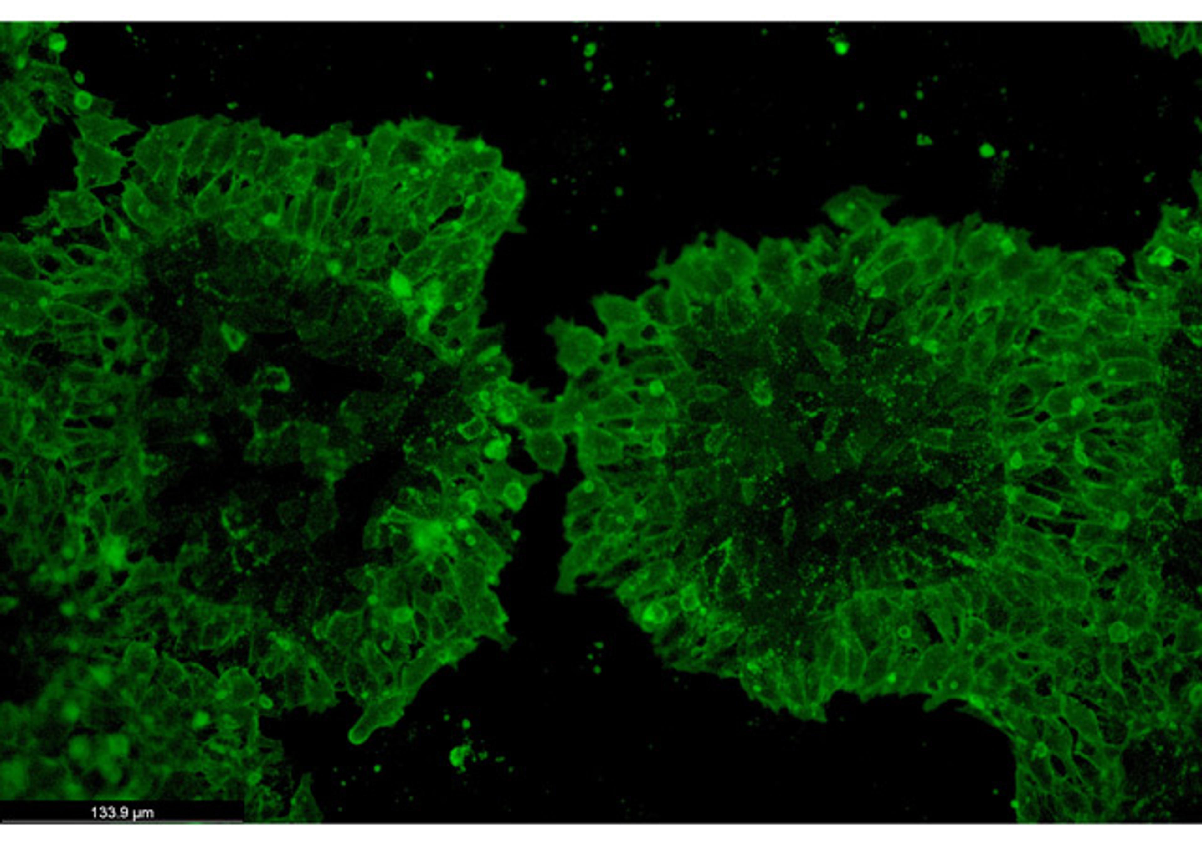 TARGATT™ iPSCs Kits - Applied StemCell - Drug Discovery & Development