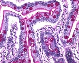 PAS staining kit - Merck KGaA, Darmstadt, Germany - Clinical Diagnostics
