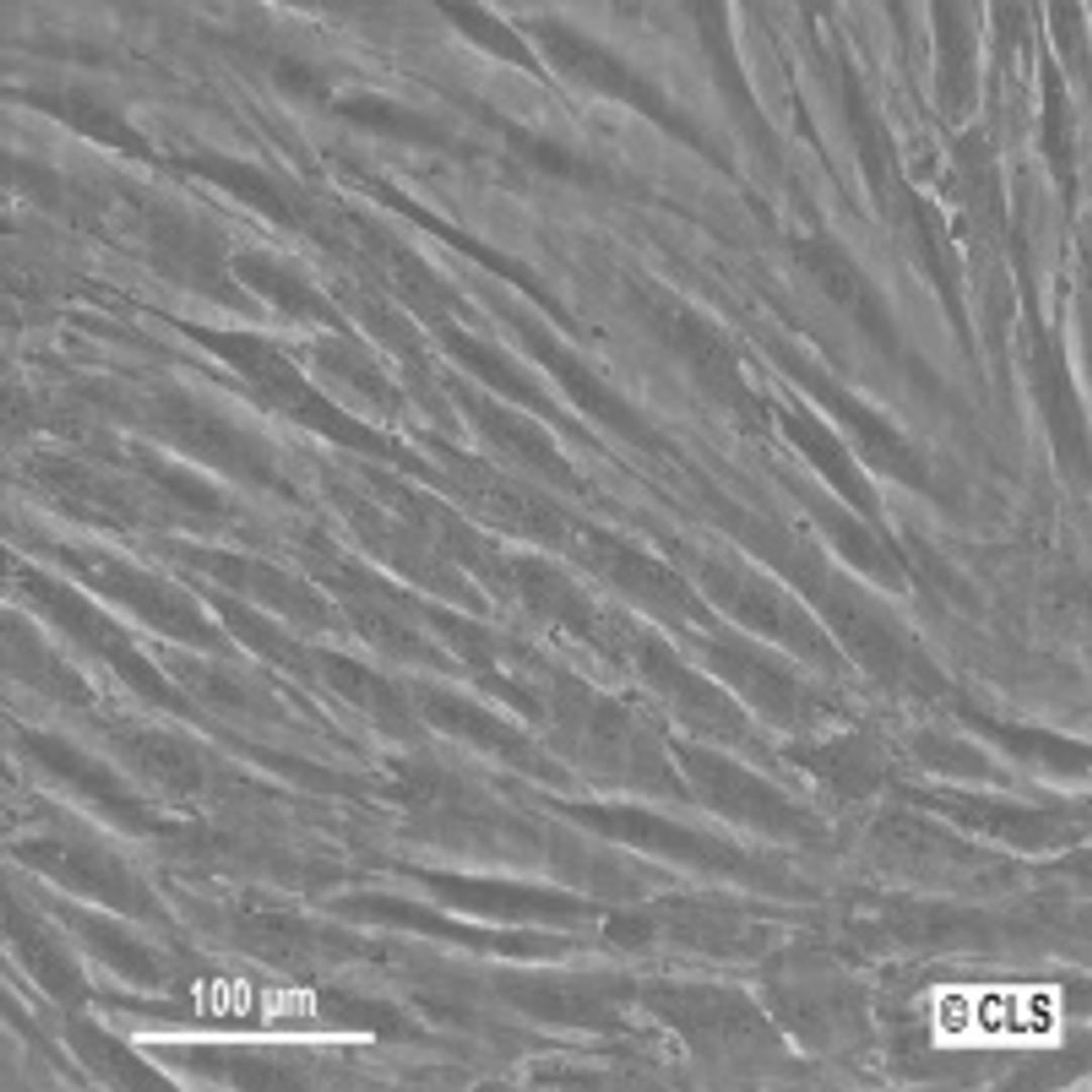 Human Gingival Fibroblasts (hGF) - Cell Lines Service GmbH - Life Sciences