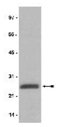 Anti-ubiquityl-Histone H2A, clone E6C5 - Upstate