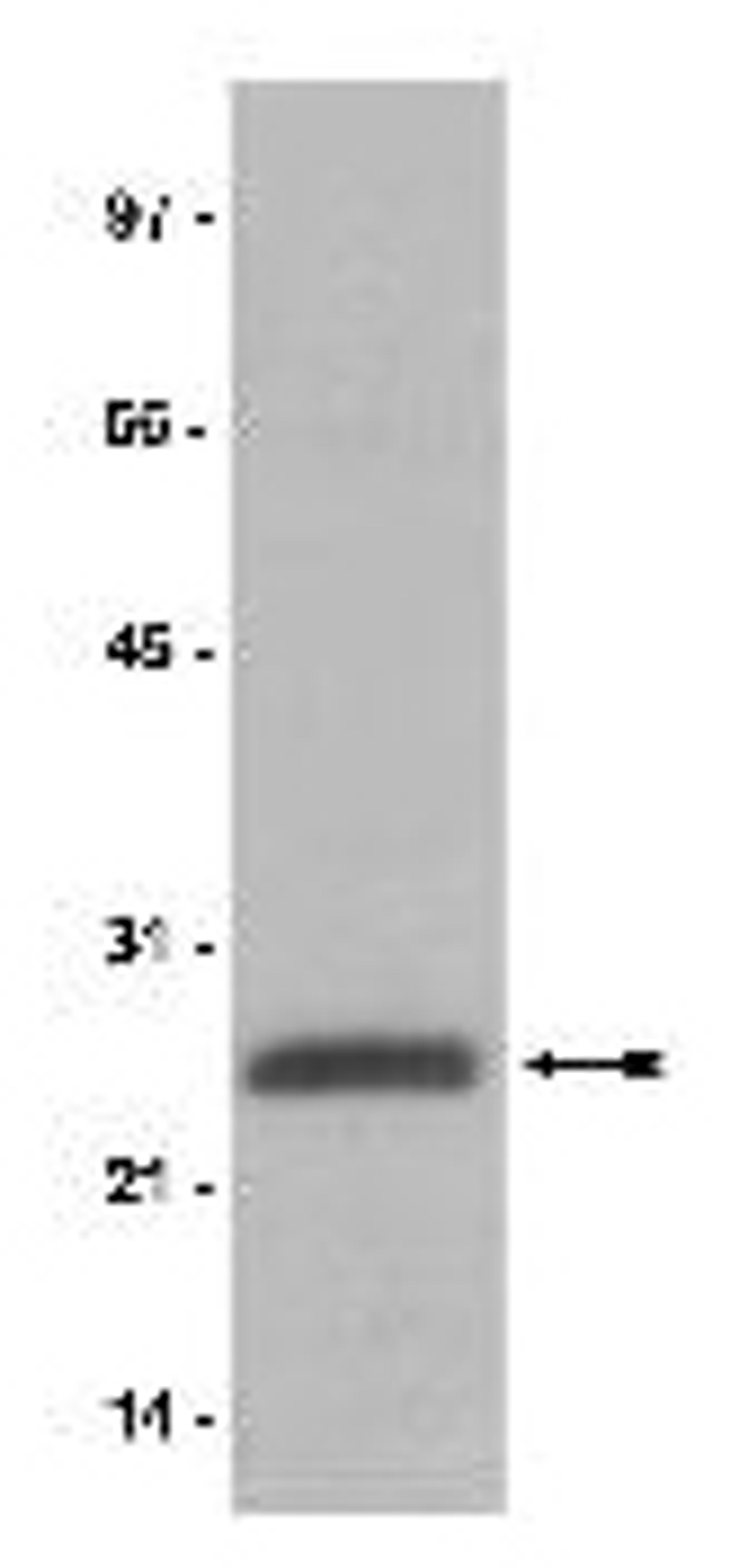 Anti-ubiquityl-Histone H2A, clone E6C5 - Upstate