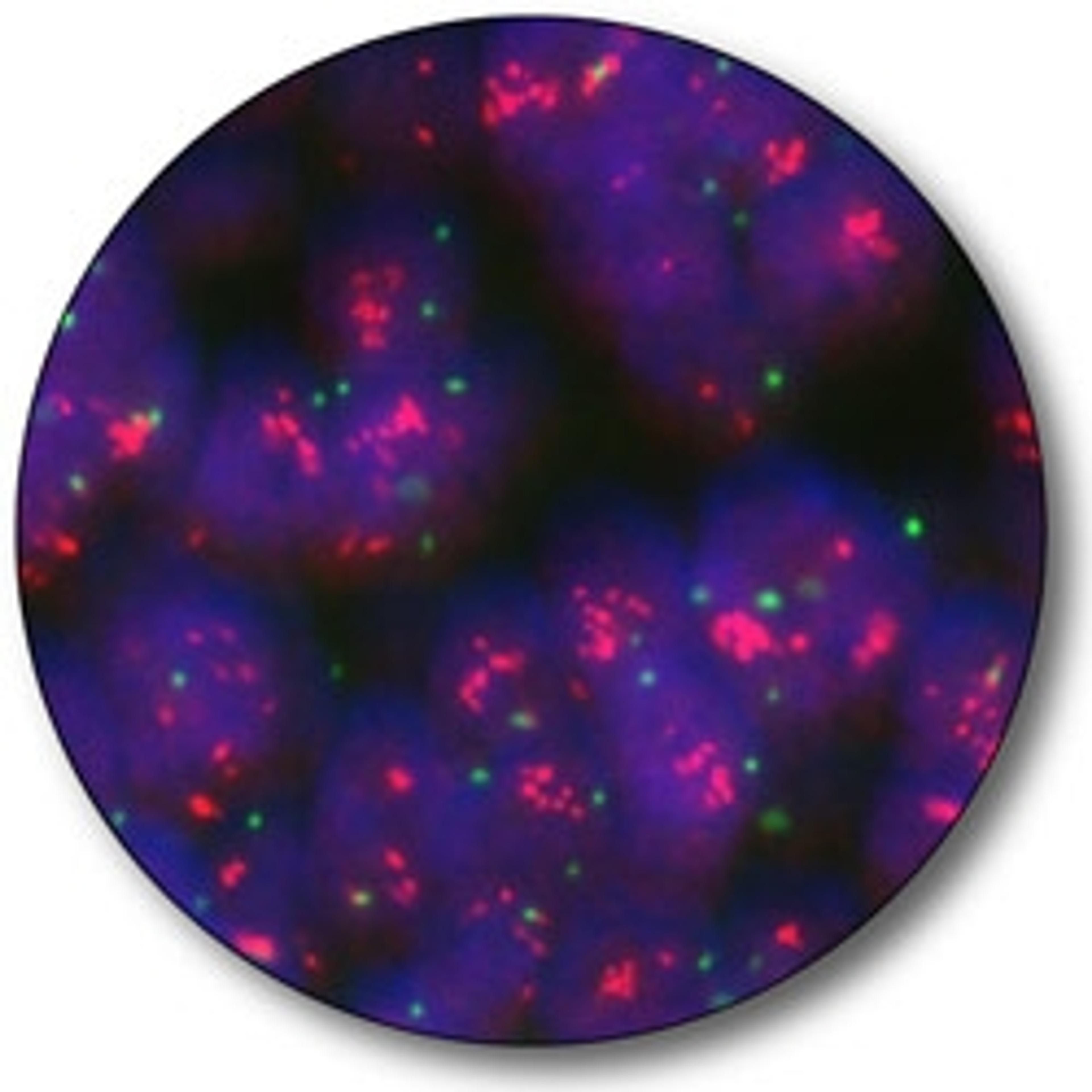 TOP2A IQFISH pharmDx™ - Agilent Technologies - Life Sciences