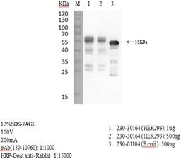 Rabbit anti-SARS-CoV-2 N-Protein antibody - RayBiotech Inc. - Life Sciences