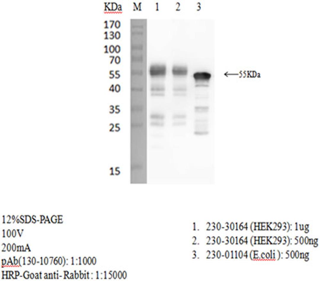 Rabbit anti-SARS-CoV-2 N-Protein antibody - RayBiotech Inc. - Life Sciences