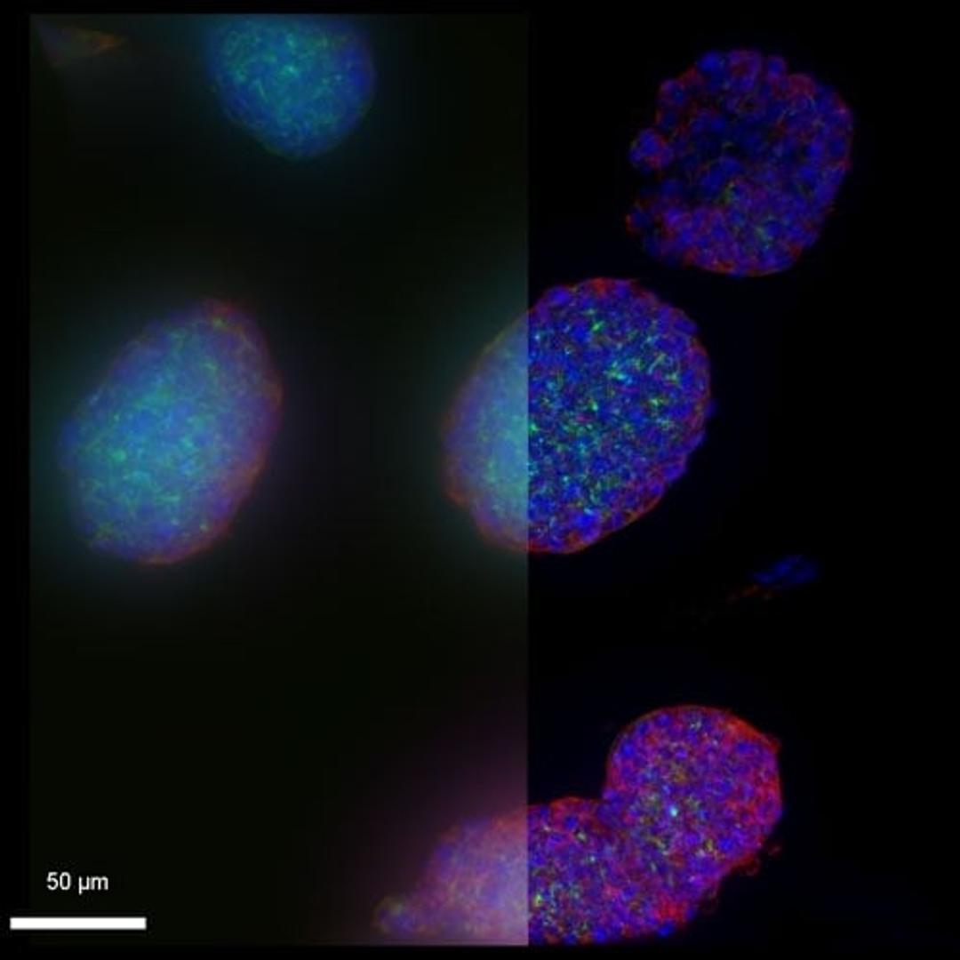 Courtesy Dr. Rémy Bonnavion, Bad Nauheim (DE)