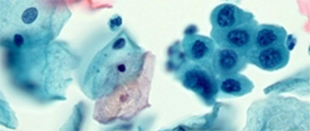 Source BioScience Cytology - Source BioScience - Clinical Diagnostics