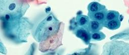 Source BioScience Cytology - Source BioScience - Clinical Diagnostics
