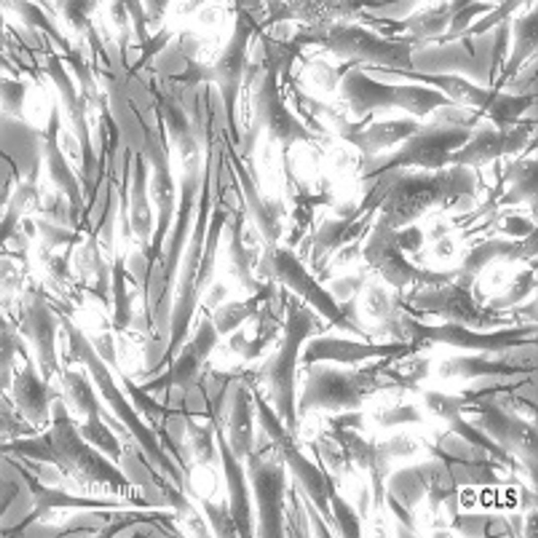 SK-MEL-28 - Cell Lines Service GmbH - Life Sciences